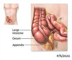 Gambar Apendiks Vermiformis