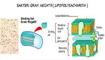 Gambar Bakteri Gram Negatif