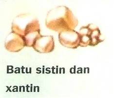 Gambar Batu Sistin