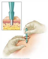 Gambar Biopsi