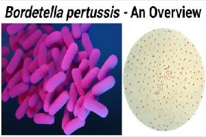 Gambar Bordetella Pertussis