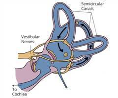 Gambar BPPV