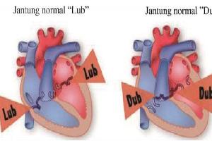 Gambar Bunyi Jantung