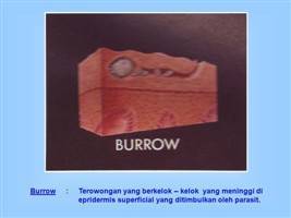 Gambar Burrow