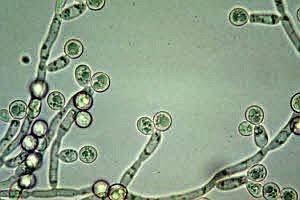 Gambar Candida Albicans