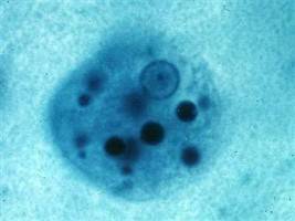 Gambar Entamoeba Histolytica