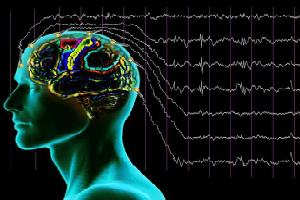 Gambar Epilepsi Idiopatik