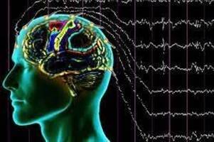 Gambar Epilepsi Simptomatik Parsial