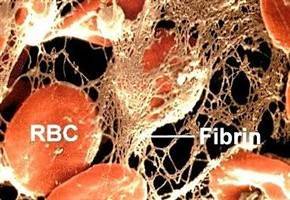 Fibrin Gambar Fibrin