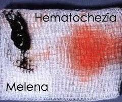 Gambar Hematokezia