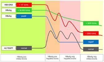 Gambar Hepatitis B Kronik