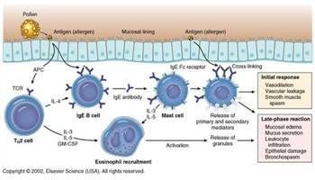 Gambar Hipersensitivitas Tipe I