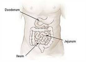 Gambar Ileum