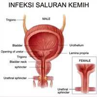 Gambar Infeksi Saluran Kemih