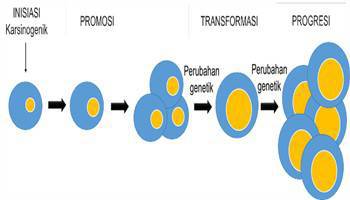 Gambar Karsinogenesis