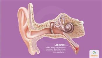 Gambar Labirinitis