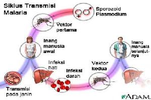 Gambar Malaria Biliosa