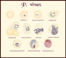 Gambar Malaria Vivax