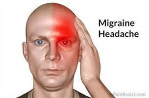 Gambar Migren