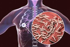 Gambar Mycobacterium Tuberculosis