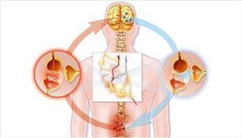 Gambar Nyeri Neuropatik