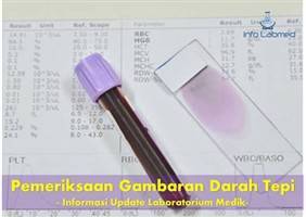 Gambar Pemeriksaan Darah Tepi