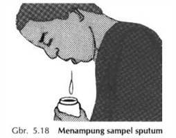 Gambar Pemeriksaan Sputum