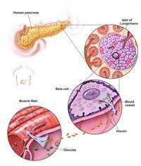 Gambar Resistensi Insulin