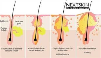 Gambar Sebum