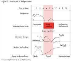 Gambar Sindrom Syok Dengue