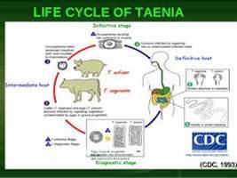 Gambar Taeniasis