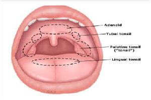 Gambar Tonsila