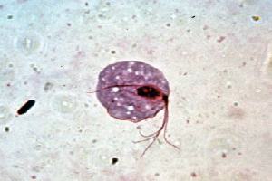 Gambar Trichomonas Vaginalis