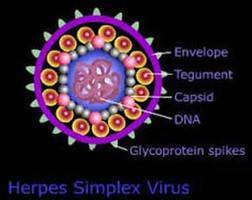 Gambar Virus Herpes Simpleks